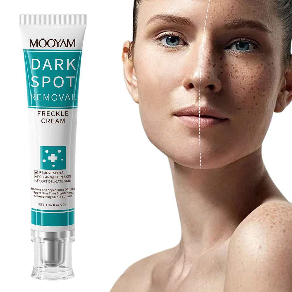 Dark spot removal face cream - 3 pieces