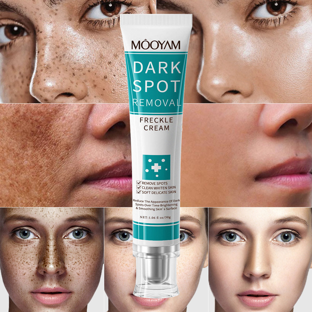 Dark spot removal face cream - 3 pieces